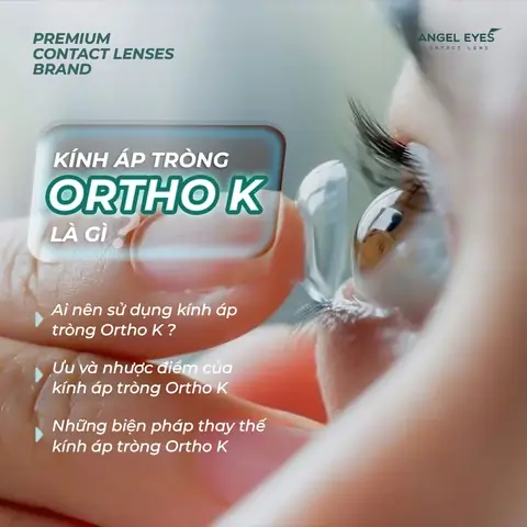 Bệnh Viện Mắt Tphcm Có Bán Kính Áp Tròng Không Bệnh Viện Mắt Tphcm Có Bán Kính Áp Tròng Không