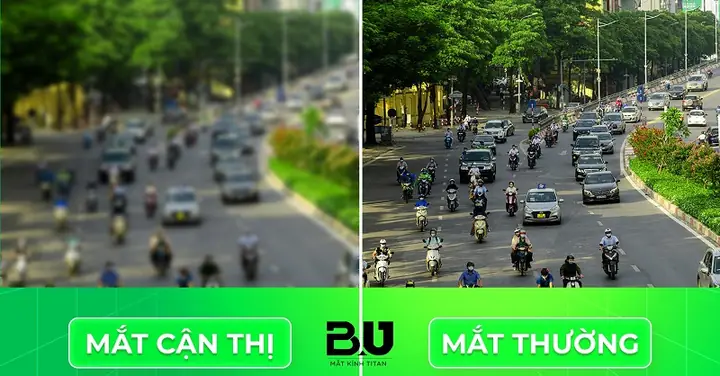 Bị Cận 1 Mắt Có Nên Đeo Kính