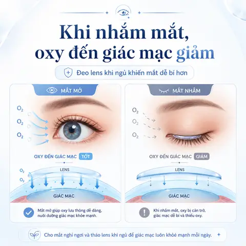 Bộ Phận Của Mắt Giống Ngư Thấu Kính