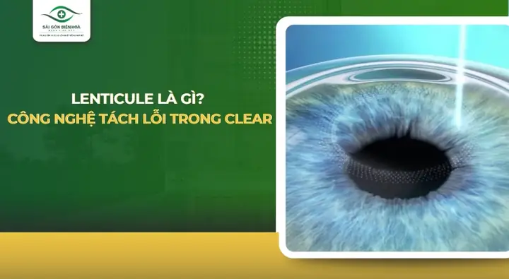 Bộ Phận Của Mắt Giống Như Thấu Kính Gì