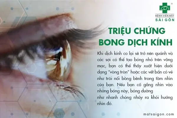 Bong Dịch Kính Mắt Dịch Sang Tiếng Anh