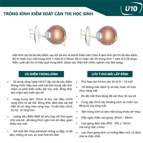Các Loại Mắt Kính Cận Và Chúc Năng
