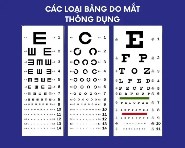 Cách Kiểm Tra Mắt Kính Cận