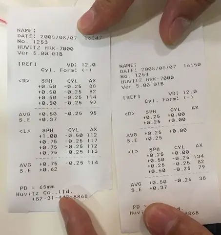 Cách Kiểm Tra Mắt Kính Cận