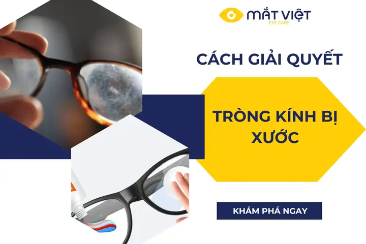 Cách Xử Lý Mắt Kính Bị Trầy