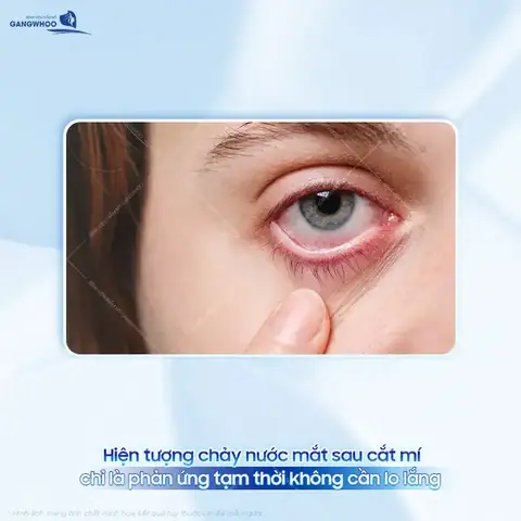 Cắt Kính Xong Bị Chảy Nước Mắt