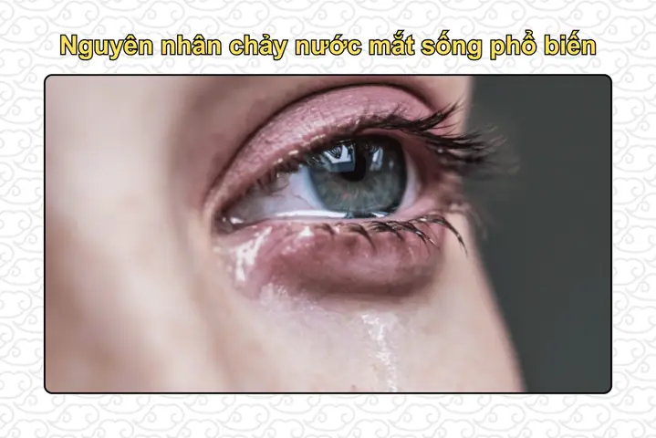 Cắt Kính Xong Bị Chảy Nước Mắt