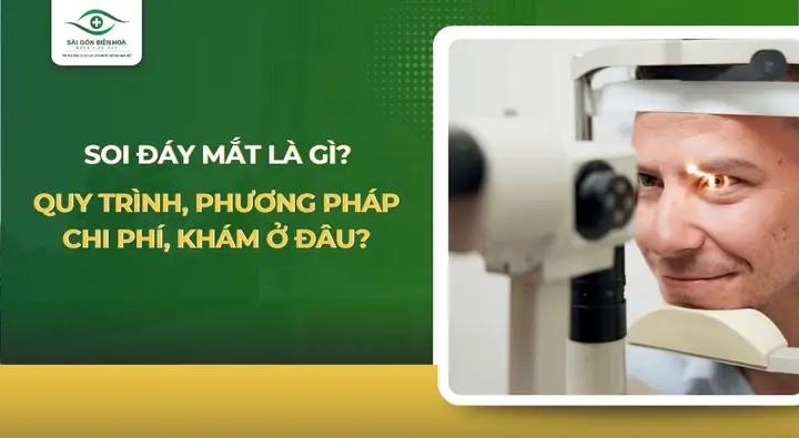 Cau Tao Kính Soi Đáy Mắt