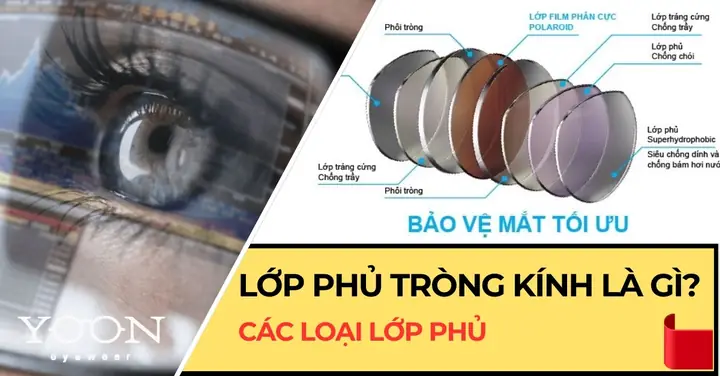 Chữ In Trên Tròng Mắt Kính