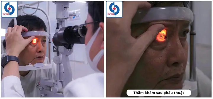 Chuyên Sỉ Đồng Hồ Mắt Kính Chuyên Sỉ Đồng Hồ Mắt Kính