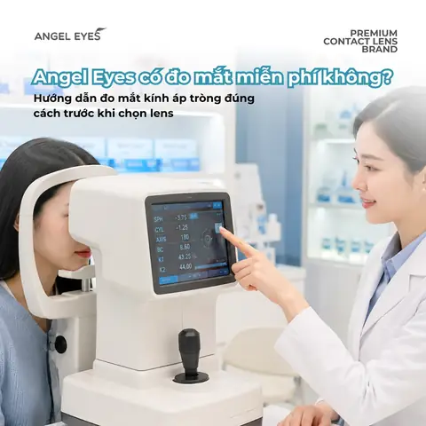 Có Cần Khám Mắt Khi Mua Kính Áp Tròng Không Có Cần Khám Mắt Khi Mua Kính Áp Tròng Không