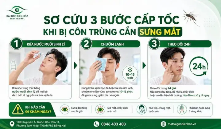 Cồn Làm Mờ Mắt Kính Ngữa