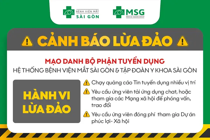 Công Ty Mắt Kính Sài Gòn Tuyen Dung Công Ty Mắt Kính Sài Gòn Tuyen Dung