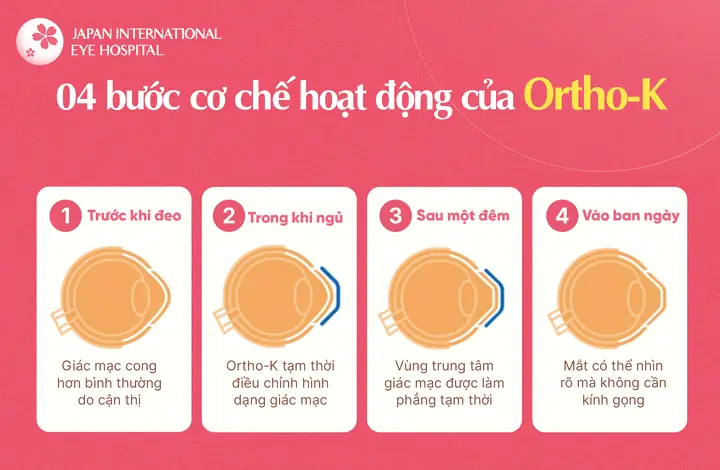 Dàn Ý Bài Văn Thuyết Minh Về Mắt Kính