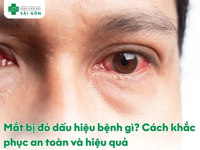 Dàn Ý Thuyết Minh Về Cái Mắt Kính Dàn Ý Thuyết Minh Về Cái Mắt Kính