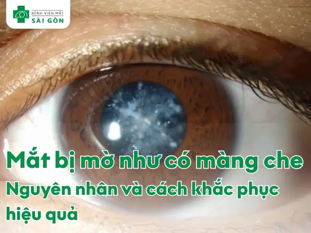 Dàn Ý Thuyết Minh Về Cái Mắt Kính Dàn Ý Thuyết Minh Về Cái Mắt Kính