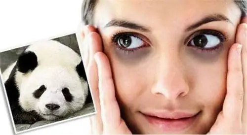 Dấu Mắt Kính Râm Dấu Mắt Kính Râm