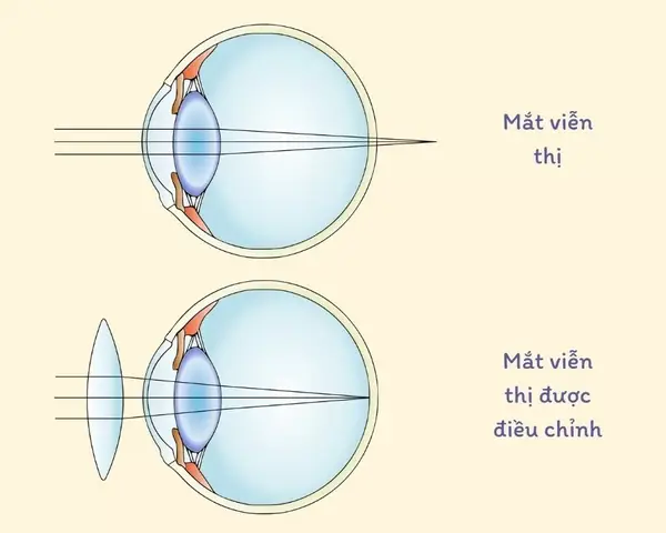 Dđeo Mắt Kính Như Thế Nào Mới Tốt Cho Mắt