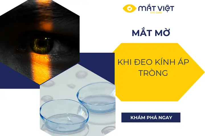Đeo Kính Áp Tròng Bị Mờ Mắt