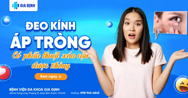 Đeo Kính Áp Tròng Có Mổ Mắt Được Không Đeo Kính Áp Tròng Có Mổ Mắt Được Không