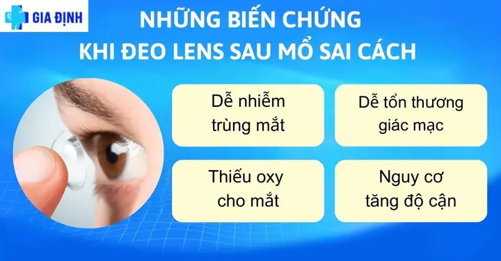 Đeo Kính Áp Tròng Có Mổ Mắt Được Không Đeo Kính Áp Tròng Có Mổ Mắt Được Không