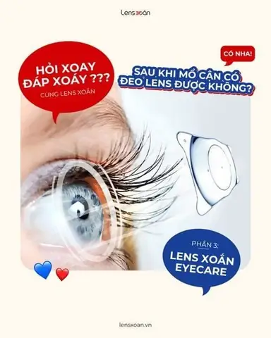 Đeo Kính Áp Tròng Có Mổ Mắt Được Không Đeo Kính Áp Tròng Có Mổ Mắt Được Không