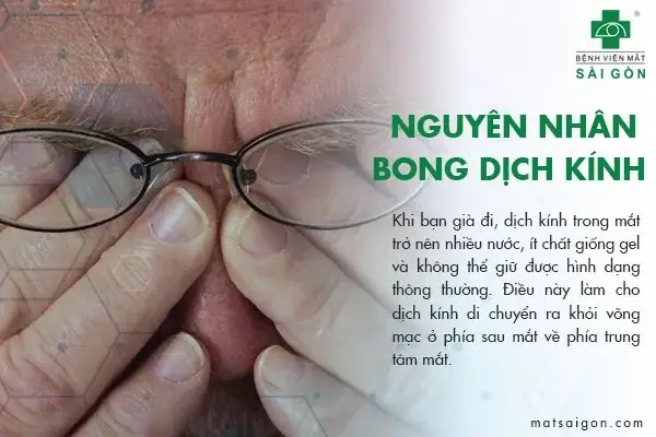 Dịch Kính Trong Mắt Dịch Sang Tiếng Anh