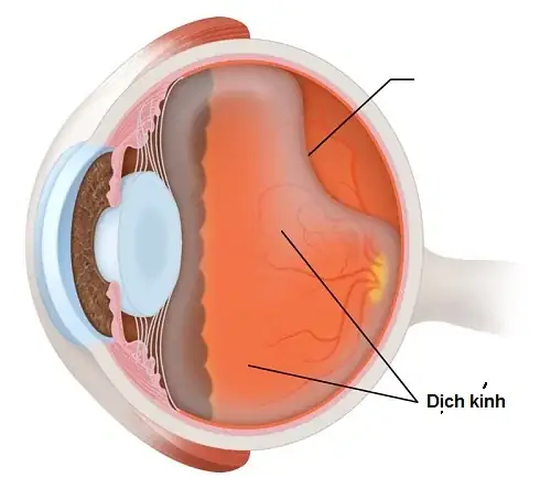 Dịch Kính Trong Mắt Dịch Sang Tiếng Anh