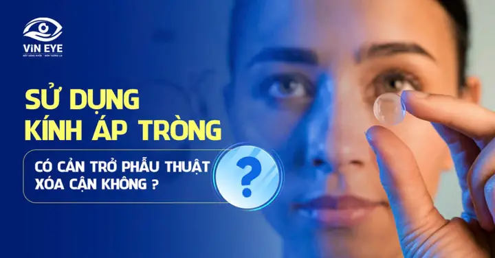 Dùng Kính Áp Tròng Có Ảnh Hưởng Đến Mắt Dùng Kính Áp Tròng Có Ảnh Hưởng Đến Mắt