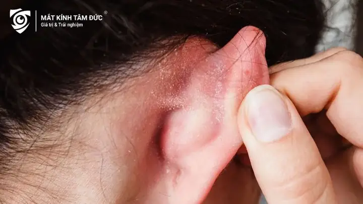 Gọng Mắt Kính Đeo Ko Bị Đau Tai Gọng Mắt Kính Đeo Ko Bị Đau Tai