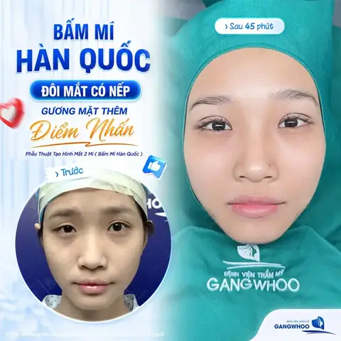 Hàn Mắt Kính Bị Gãy Đẹp Hồ Chí Minh Hàn Mắt Kính Bị Gãy Đẹp Hồ Chí Minh