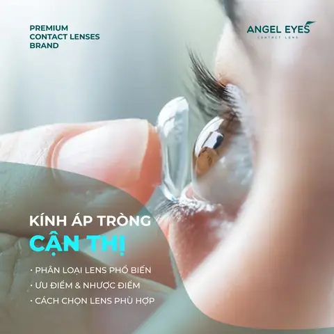 Hướng Dẫn Chọn Laoij Mắt Kính Cận Hướng Dẫn Chọn Laoij Mắt Kính Cận