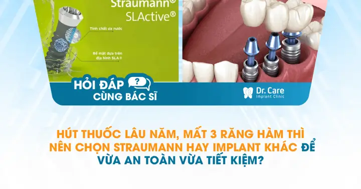 Hướng Dẫn Ghép Điếu Thuốc Và Mắt Kính Trong Prem