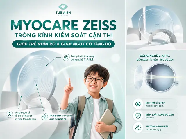 Khoảng Cách Từ Kính Đến Mắt Là Gì Khoảng Cách Từ Kính Đến Mắt Là Gì