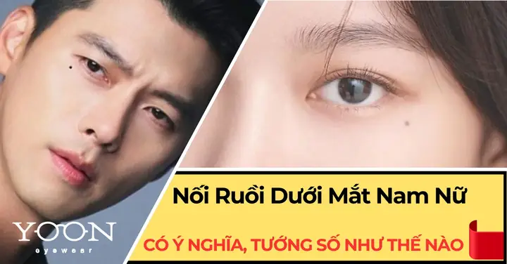 Kính Cận Mắt Ruồi Nam