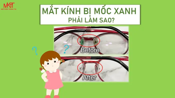 Kính Mắt Bị Rêu