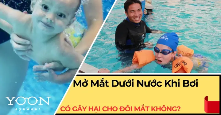 Kính Mát Có Gây Hại Cho Mắt