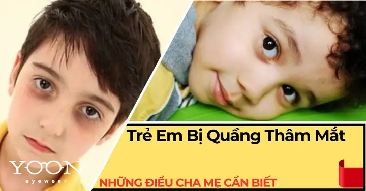 Kính Mắt Mè