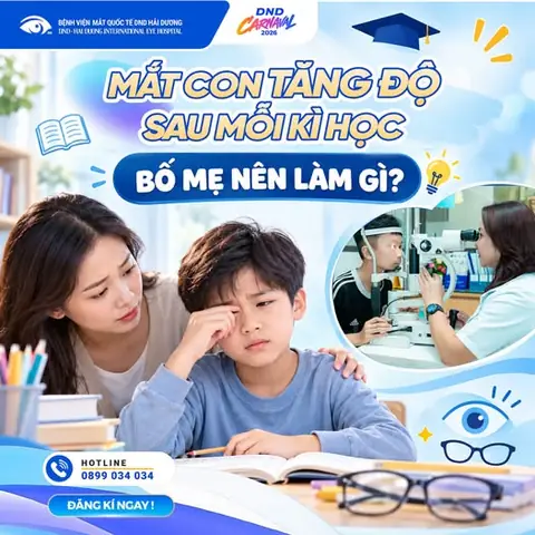 Kính Mắt Mè