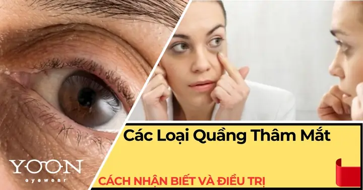 Kính Mắt Quang Nhẫn