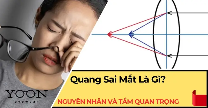 Kính Mắt Quang Nhẫn