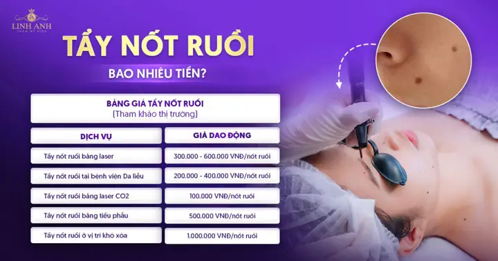 Kính Mắt Ruồi Giá Rẻ Kính Mắt Ruồi Giá Rẻ