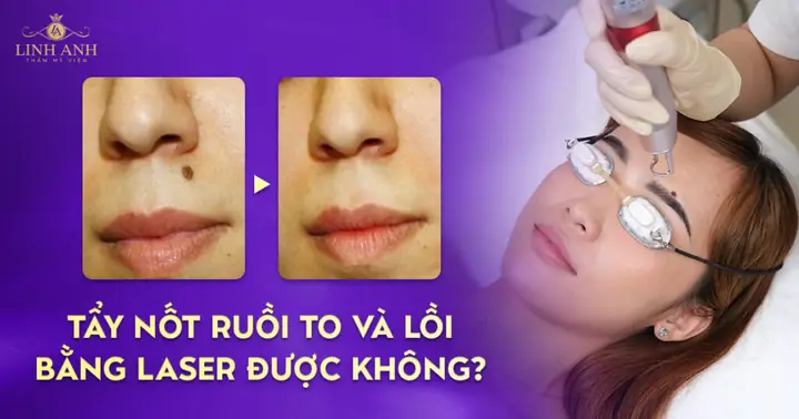 Kính Mắt Ruồi Giá Rẻ Kính Mắt Ruồi Giá Rẻ