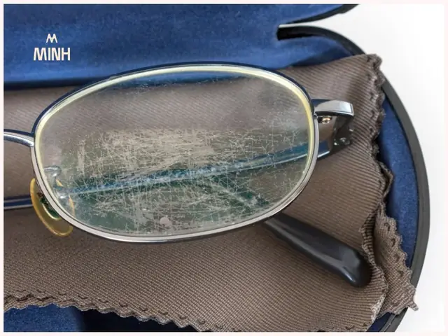 Mắt Kính Bị Trầy