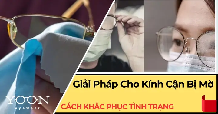 Mắt Kính Cận Của Pháp