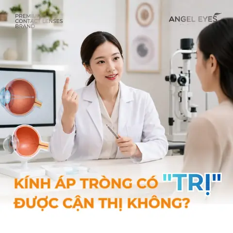 Mắt Kính Trị Cận Thị Mắt Kính Trị Cận Thị